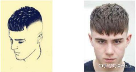 (男人额头宽窄有什么说法)男人额头宽窄也看运势,几指宽最适合面相长相评断